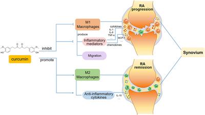 Immunomodulatory effects of curcumin on macrophage polarization in rheumatoid arthritis